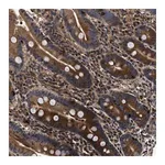Merck Anti-ABCG8 antibody produced in rabbit