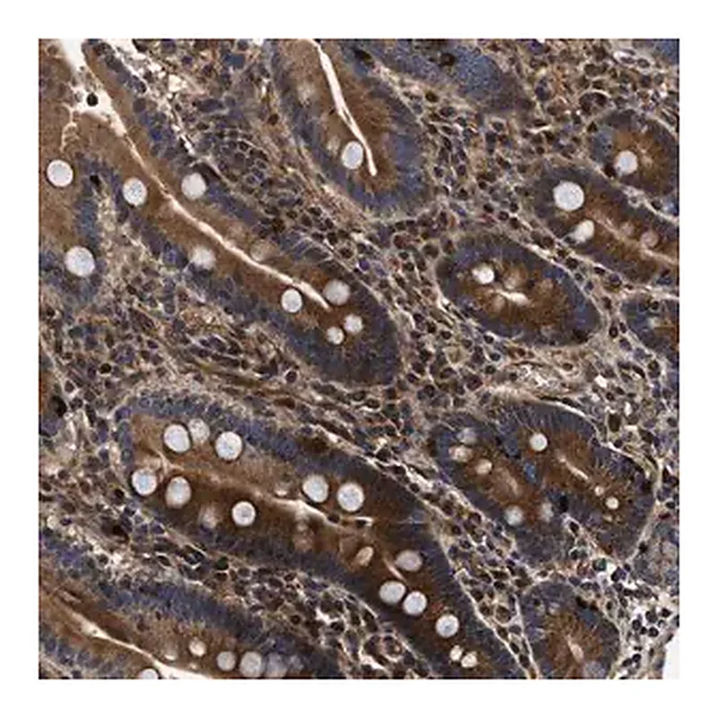 Merck Anti-ABCG8 antibody produced in rabbit