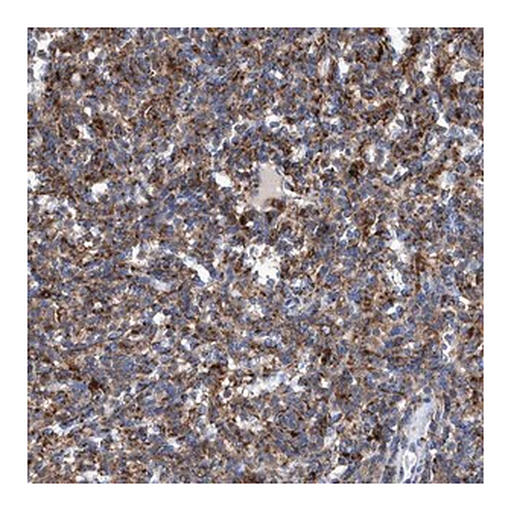 Merck Anti-TRIM65 antibody produced in rabbit