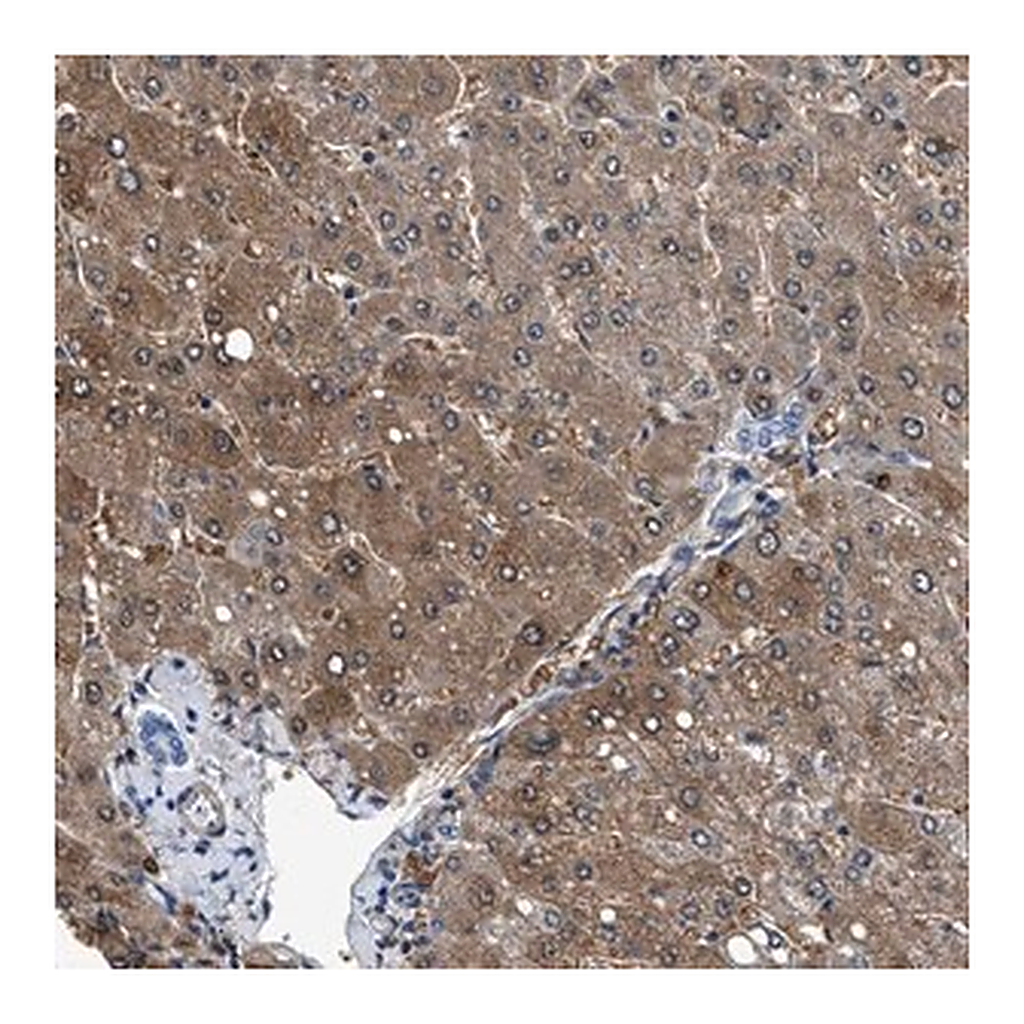 Merck Anti-CDRT4 antibody produced in rabbit