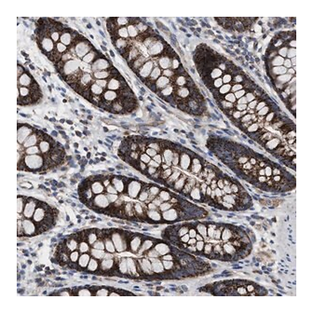 Merck Anti-MRM1 antibody produced in rabbit