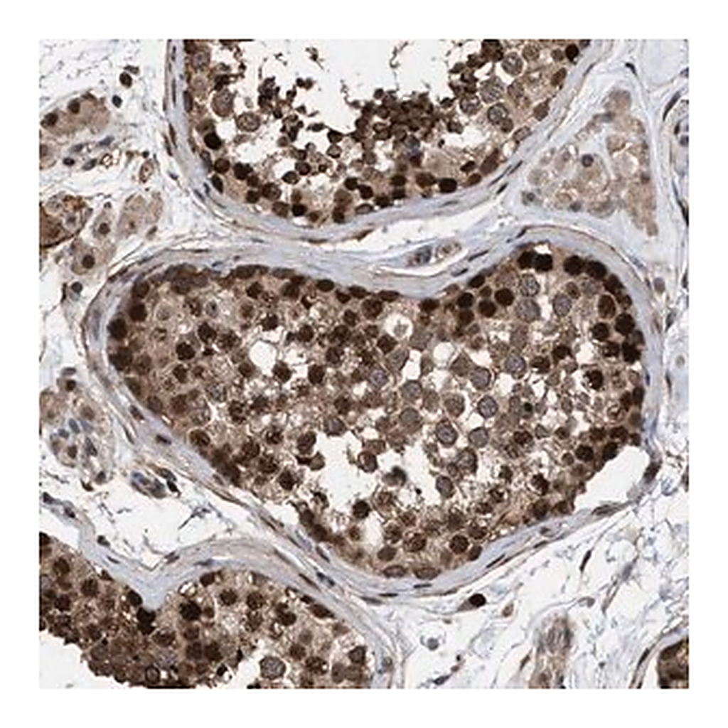 Merck Anti-TP53BP2 antibody produced in rabbit