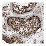 Merck Anti-TP53BP2 antibody produced in rabbit