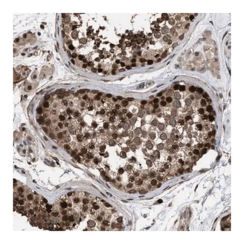 Merck Anti-TP53BP2 antibody produced in rabbit