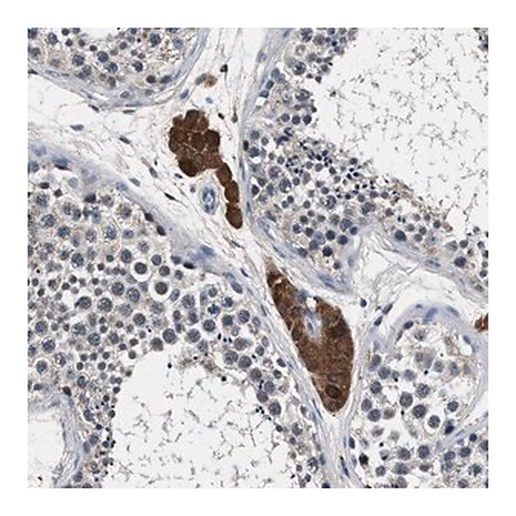 Merck Anti-DENND6B antibody produced in rabbit