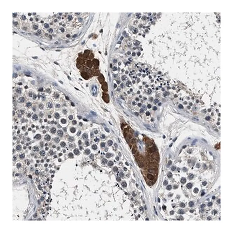Merck Anti-DENND6B antibody produced in rabbit