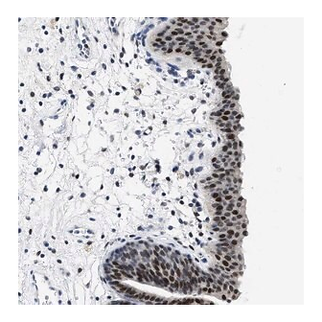 Merck Anti-SETD1B antibody produced in rabbit