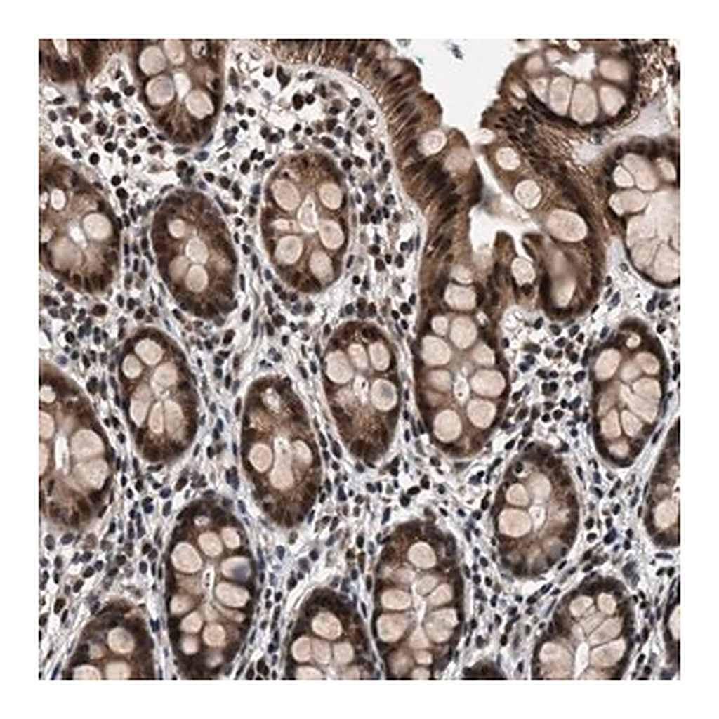 Merck Anti-RBM33 antibody produced in rabbit