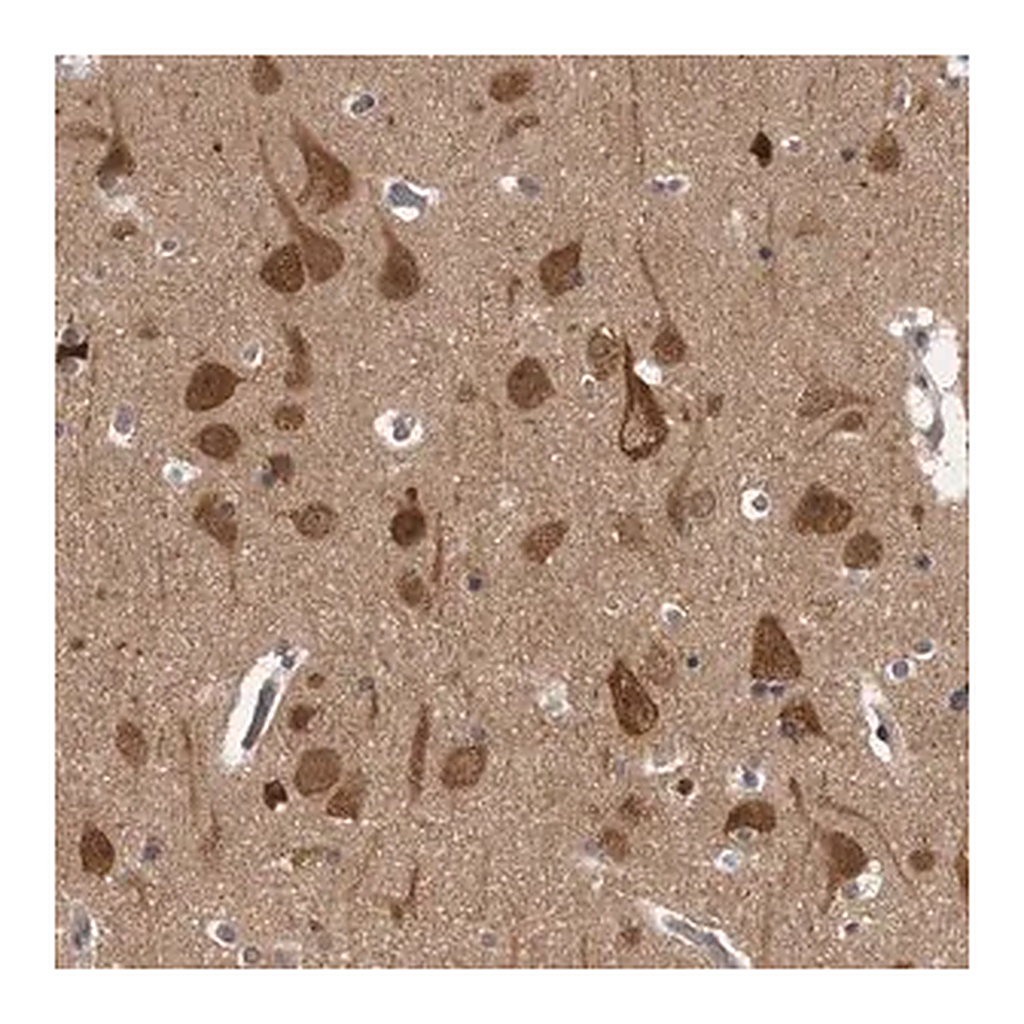Merck Anti-CACYBP antibody produced in rabbit