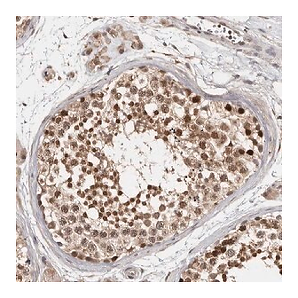 Merck Anti-ZNF83 antibody produced in rabbit