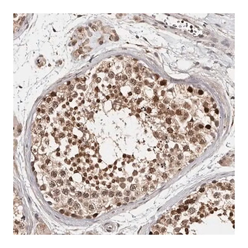 Merck Anti-ZNF83 antibody produced in rabbit