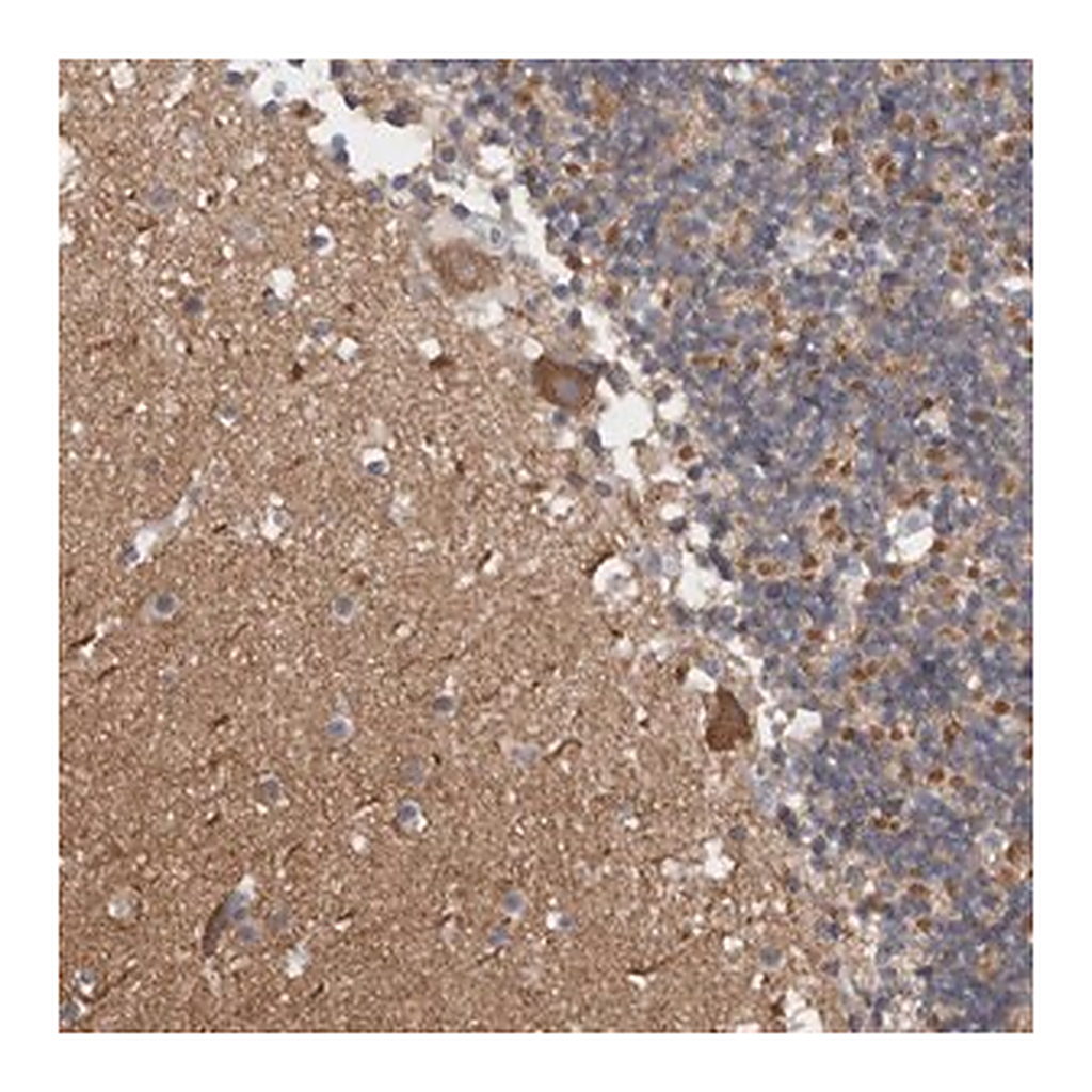 Merck Anti-CAMK2D antibody produced in rabbit