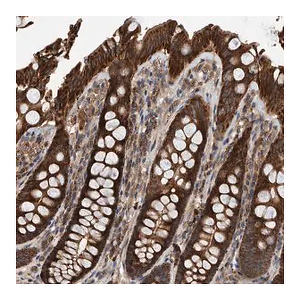 Merck Anti-ABCA5 antibody produced in rabbit