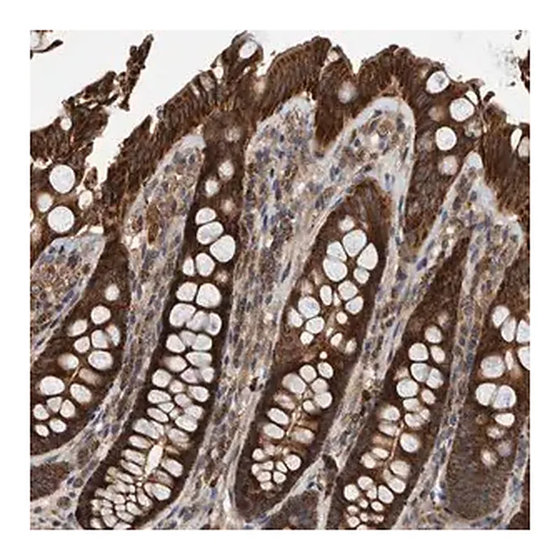Merck Anti-ABCA5 antibody produced in rabbit