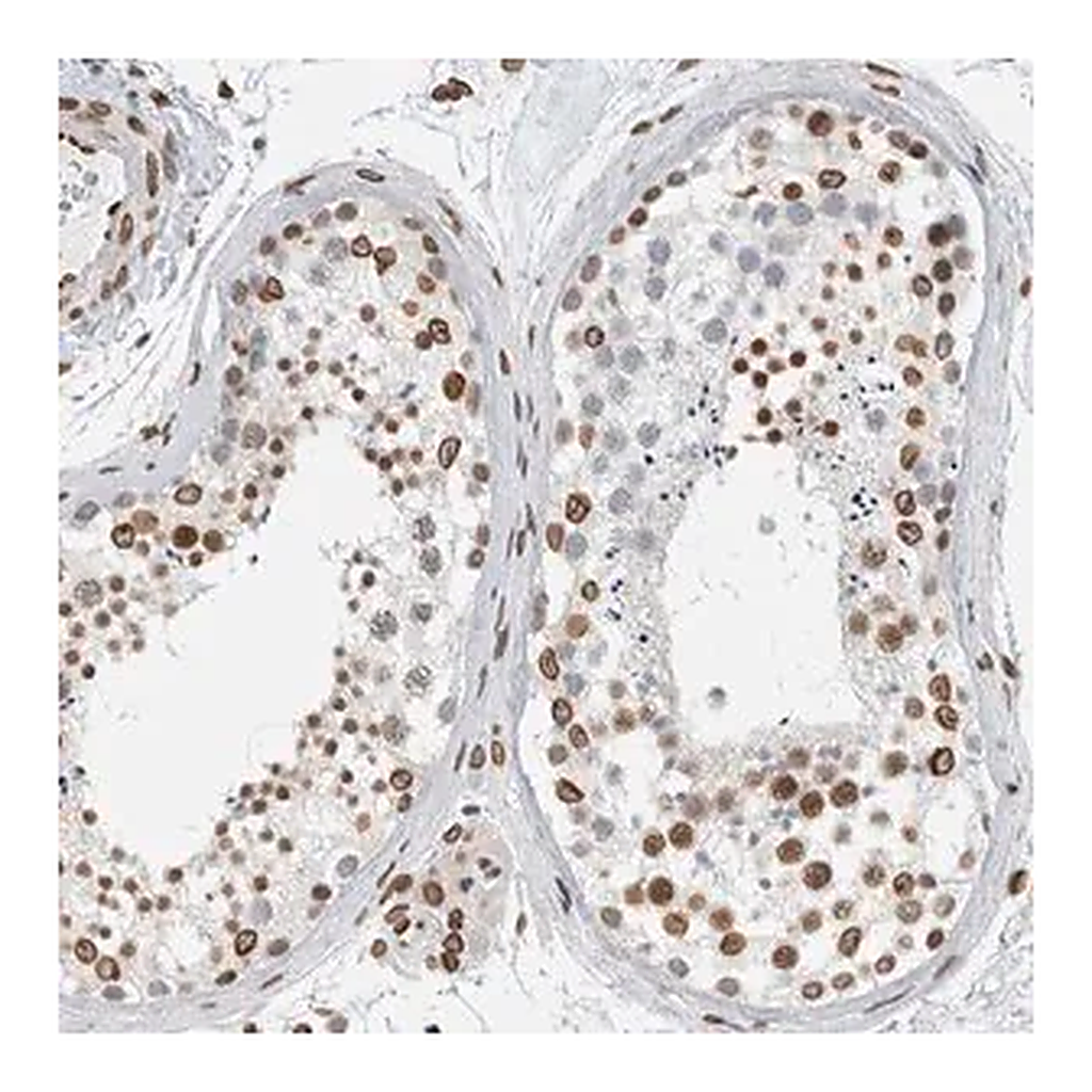 Merck Anti-CDCA2 antibody produced in rabbit