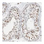 Merck Anti-CDCA2 antibody produced in rabbit