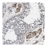 Merck Anti-NKTR antibody produced in rabbit