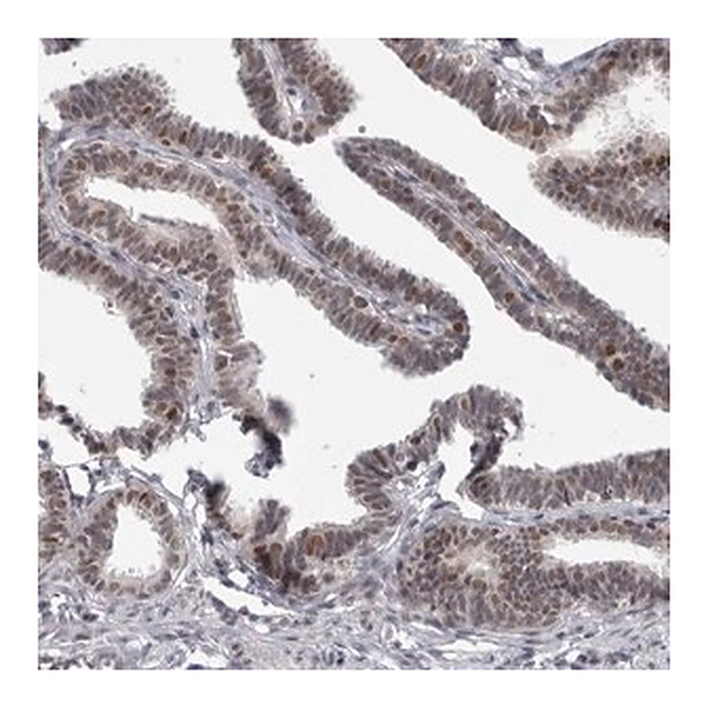 Merck Anti-PSMB2 antibody produced in rabbit