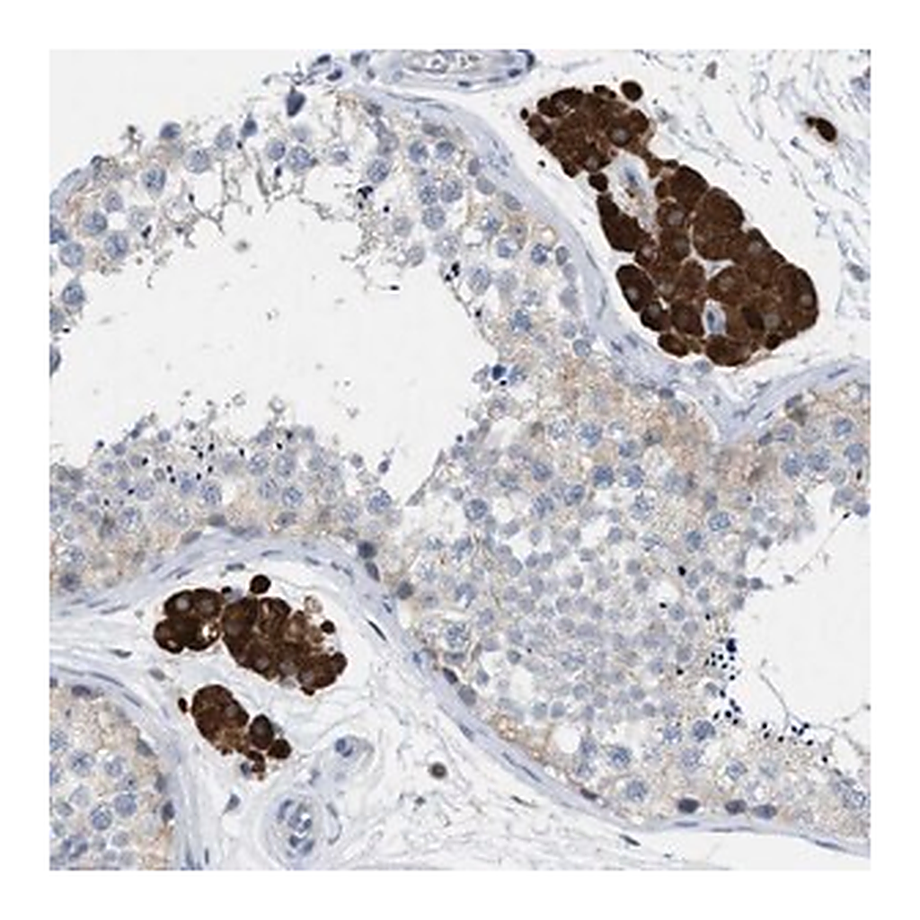 Merck Anti-PPM1D antibody produced in rabbit