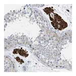 Merck Anti-PPM1D antibody produced in rabbit