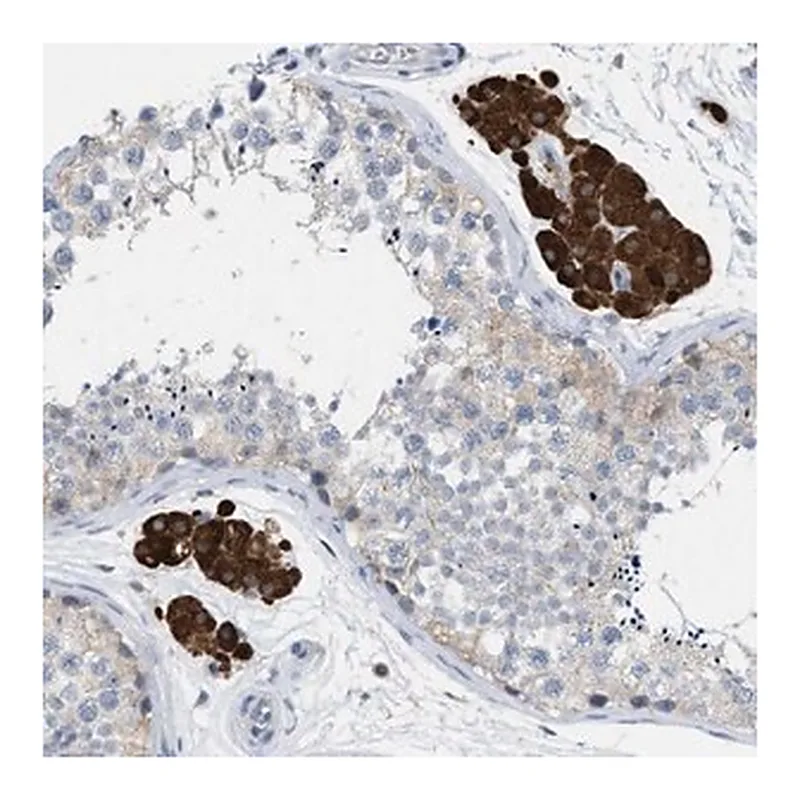 Merck Anti-PPM1D antibody produced in rabbit