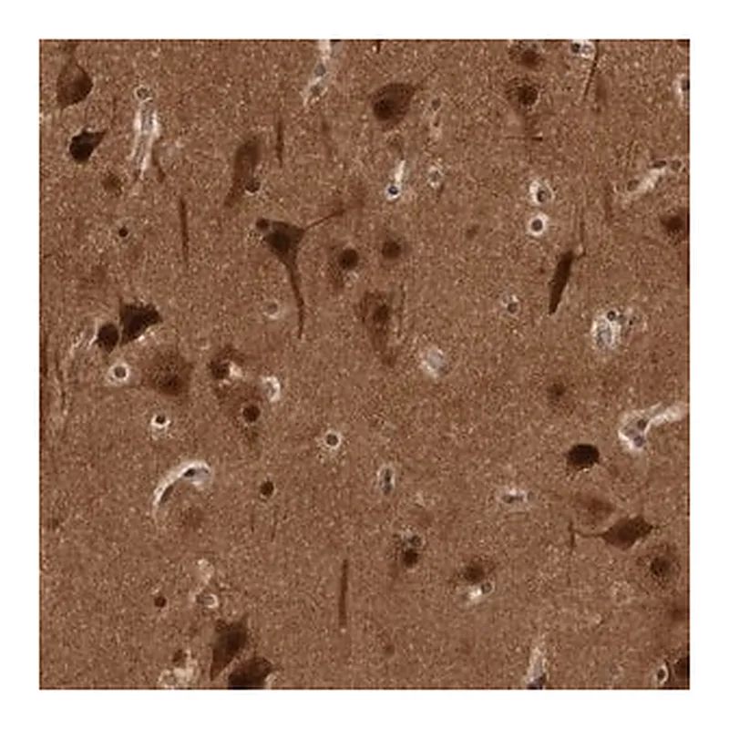 Merck Anti-AKT3 antibody produced in rabbit