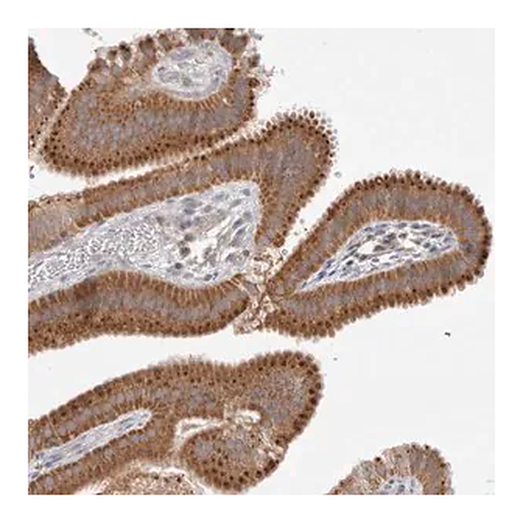 Merck Anti-NPC1 antibody produced in rabbit