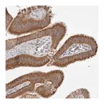 Merck Anti-NPC1 antibody produced in rabbit