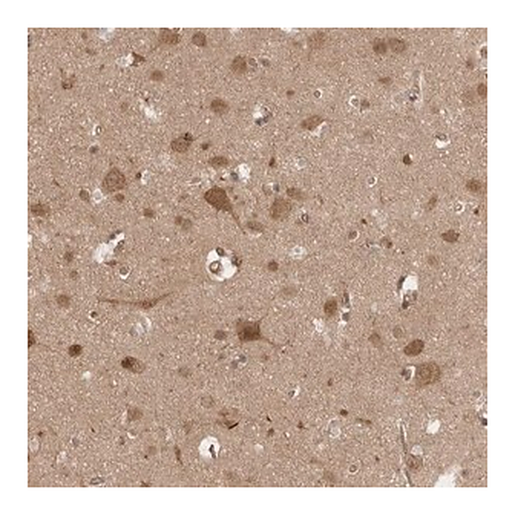 Merck Anti-VPS50 antibody produced in rabbit