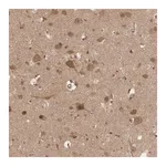 Merck Anti-VPS50 antibody produced in rabbit