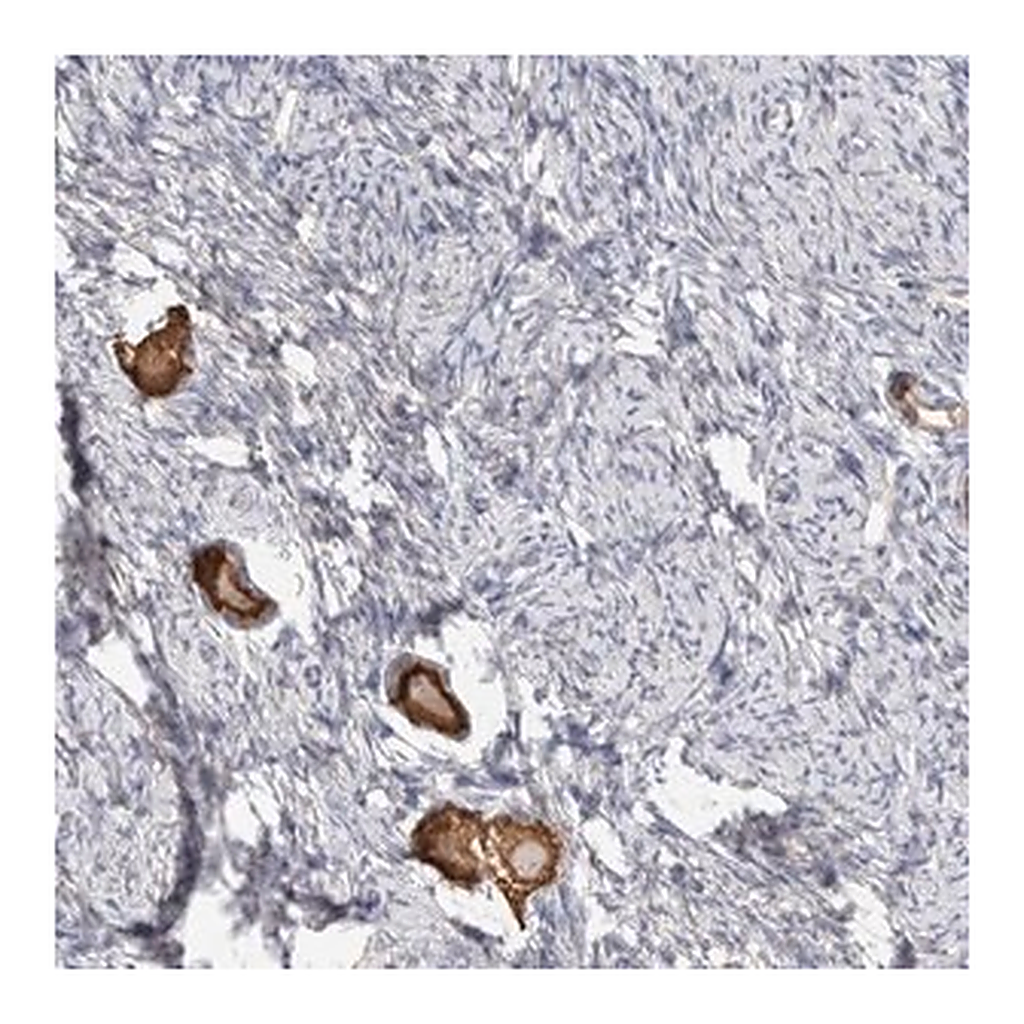 Merck Anti-ANKMY1 antibody produced in rabbit