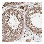 Merck Anti-PKD1L1 antibody produced in rabbit