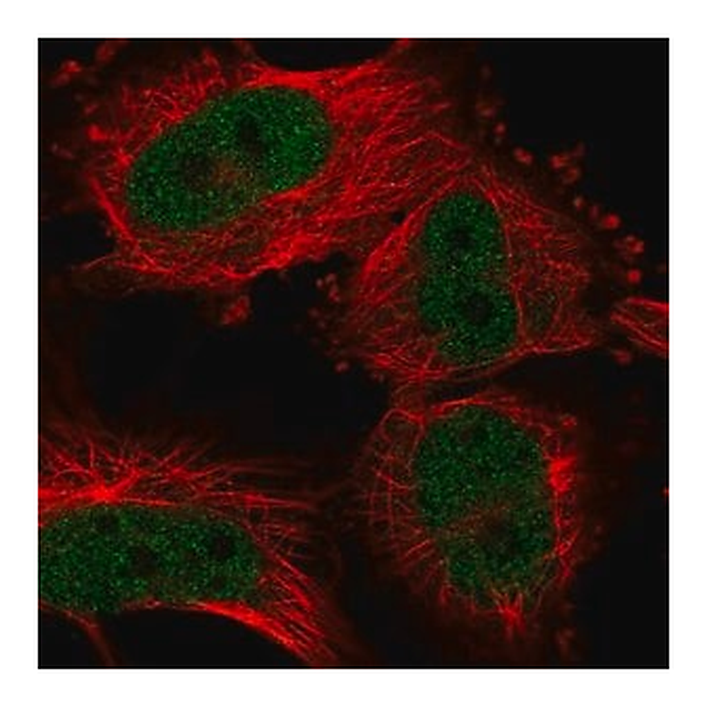 Merck Anti-UHRF2 antibody produced in rabbit