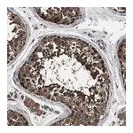 Merck Anti-RNF216 antibody produced in rabbit
