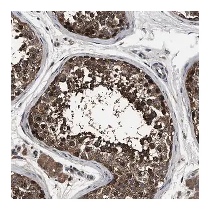 Merck Anti-RNF216 antibody produced in rabbit