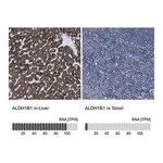 Merck Anti-ALDH1B1 antibody produced in rabbit