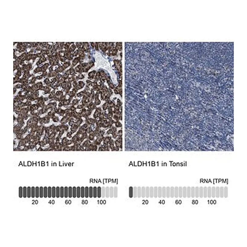 Merck Anti-ALDH1B1 antibody produced in rabbit