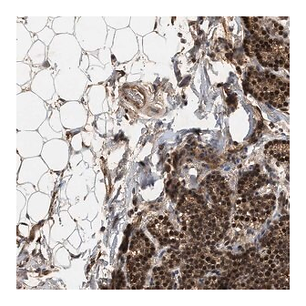 Merck Anti-RUSC2 antibody produced in rabbit