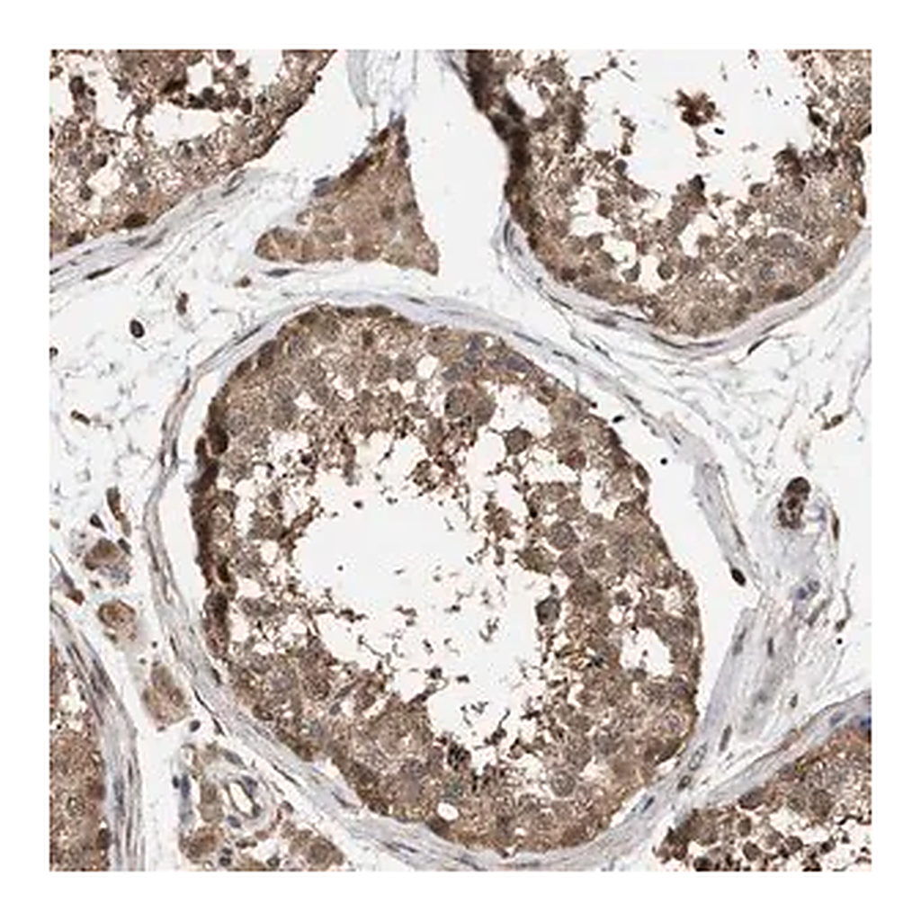 Merck Anti-NAA35 antibody produced in rabbit