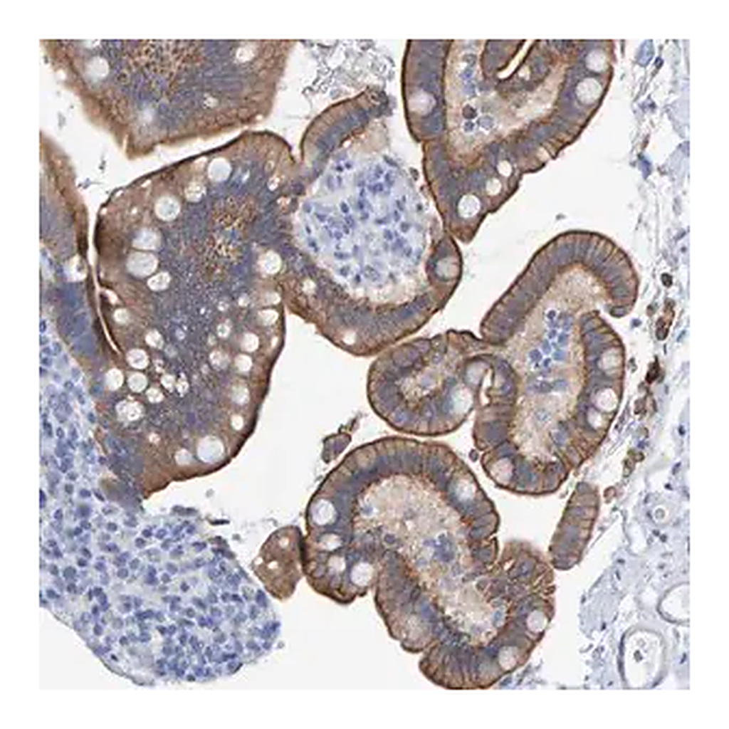 Merck Anti-JAKMIP3 antibody produced in rabbit