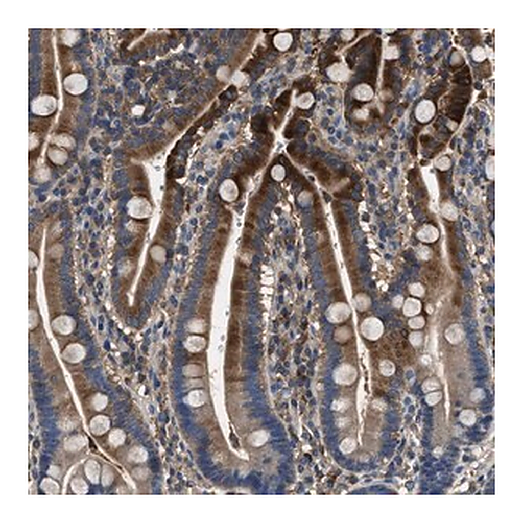 Merck Anti-BLOC1S1 antibody produced in rabbit