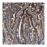 Merck Anti-BLOC1S1 antibody produced in rabbit