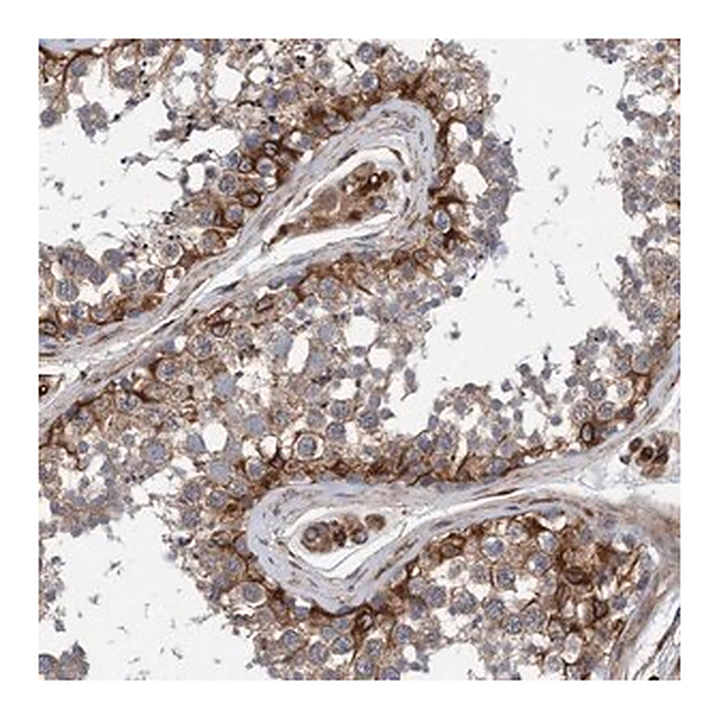 Merck Anti-STXBP4 antibody produced in rabbit