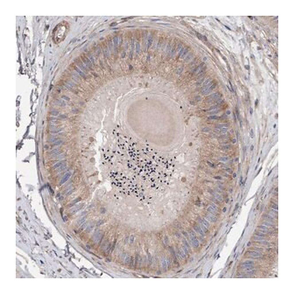 Merck Anti-CDK5RAP3 antibody produced in rabbit