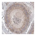 Merck Anti-CDK5RAP3 antibody produced in rabbit