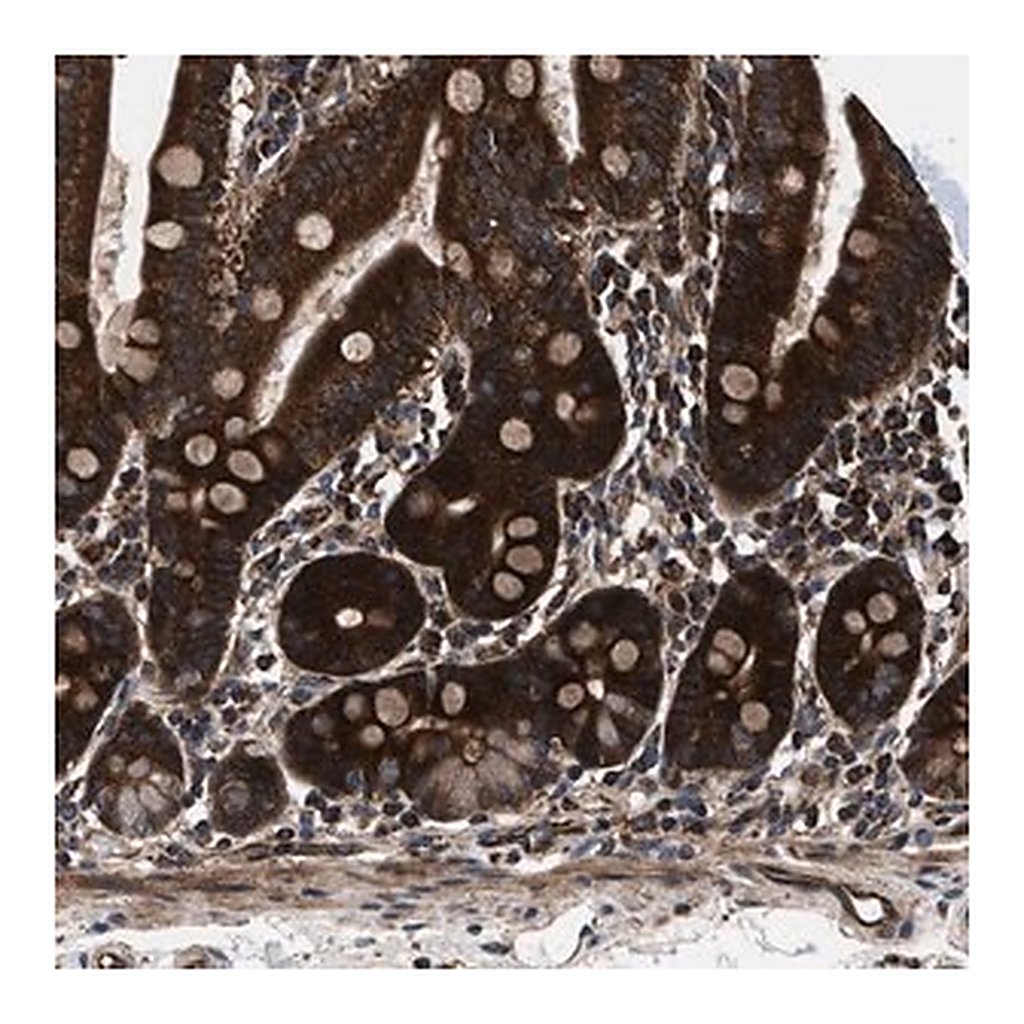 Merck Anti-PRR15L antibody produced in rabbit