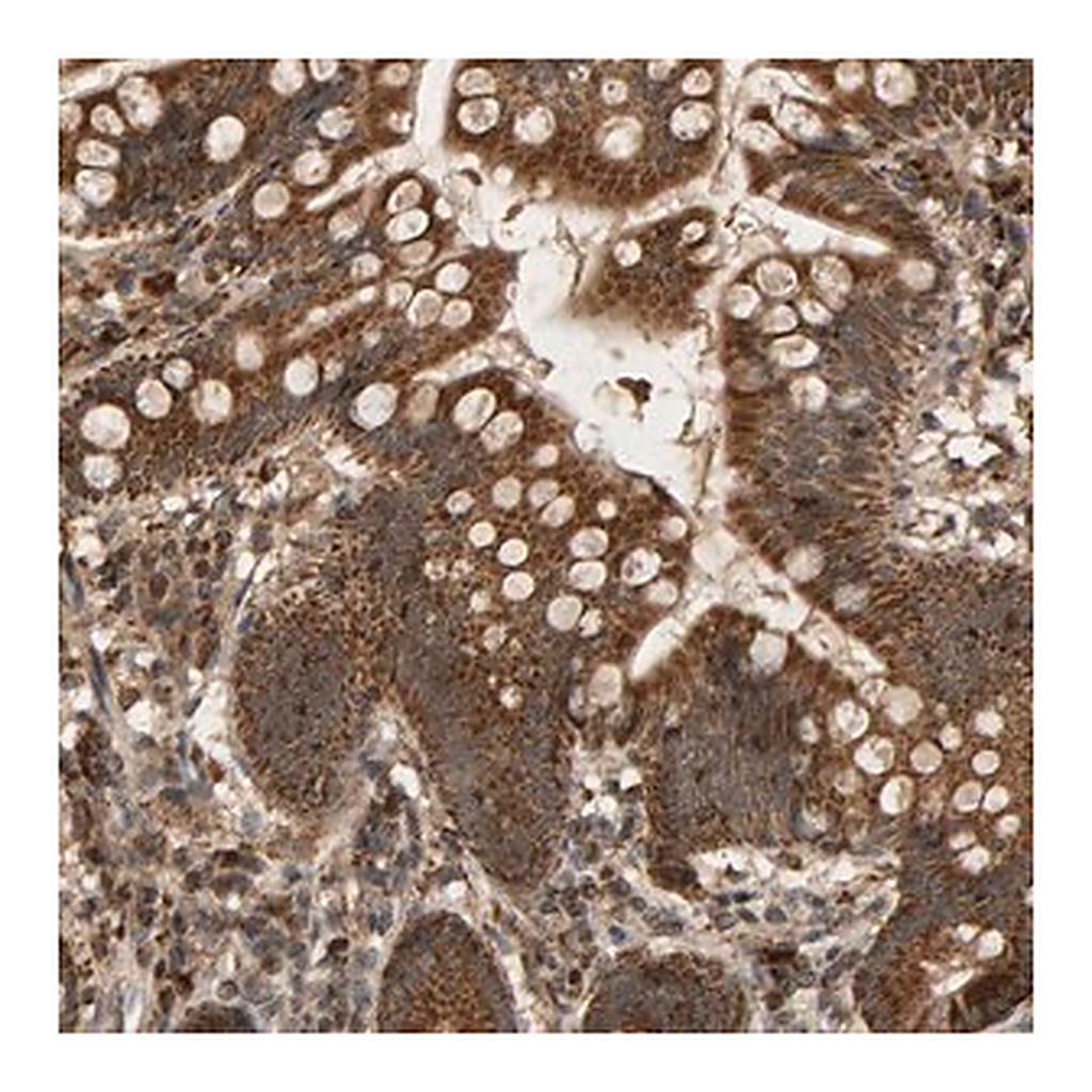 Merck Anti-GSTK1 antibody produced in rabbit