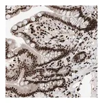 Merck Anti-C17orf49 antibody produced in rabbit