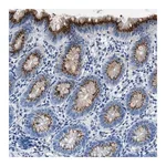 Merck Anti-VPS53 antibody produced in rabbit