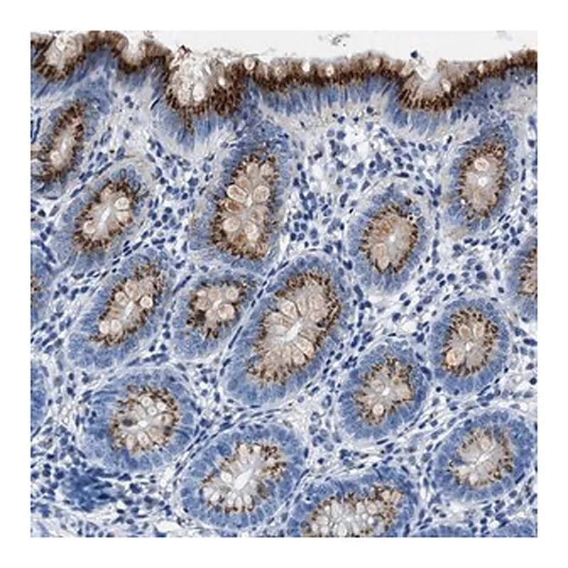 Merck Anti-VPS53 antibody produced in rabbit